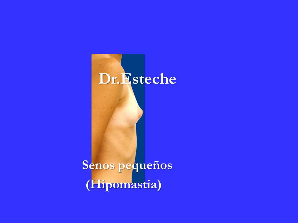 Hentay las muchachas con un pequeño pecho